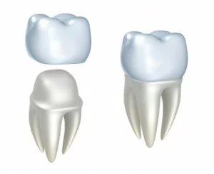 Dental-Crown