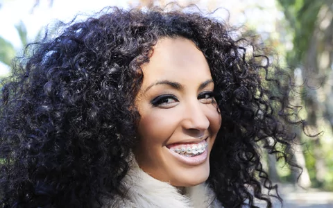 Traditional braces in Yuma and Fortuna Foothills