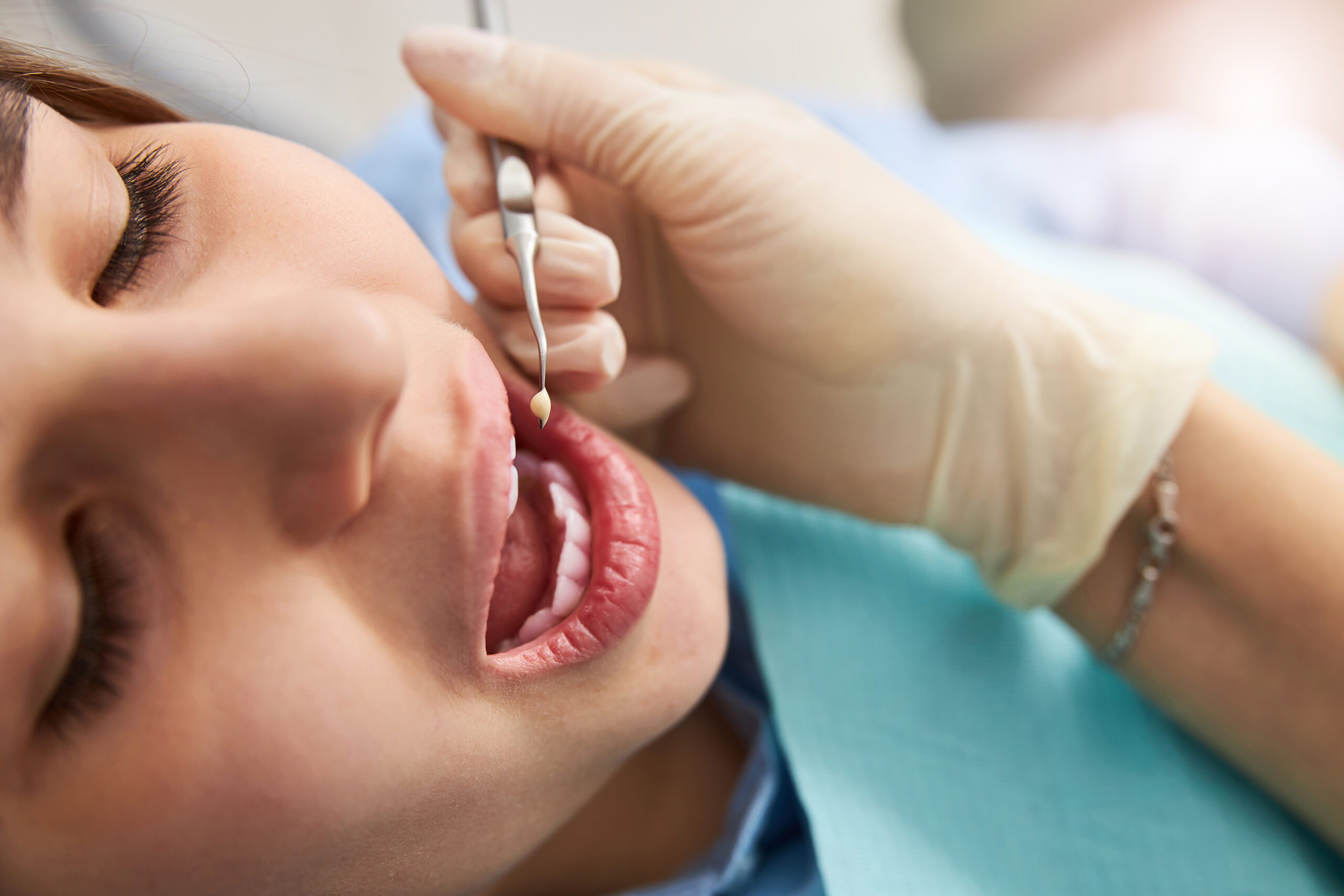 dentist removing a patients amalgam filling, mercury-free dentist